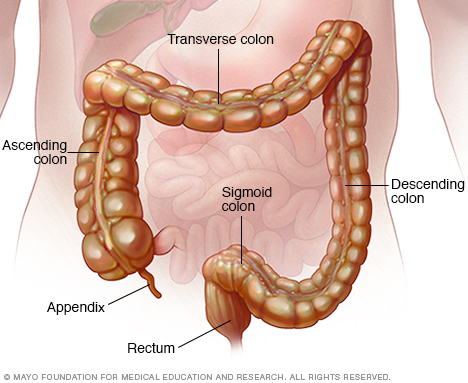 Colitis microscópica