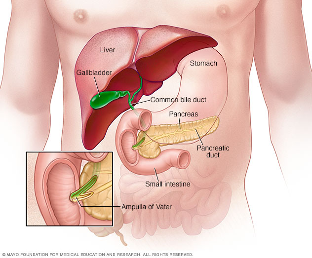 Ampullary cancer