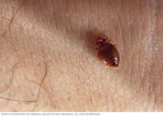 Bedbugs