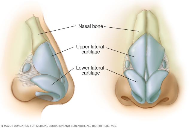 Rhinoplasty