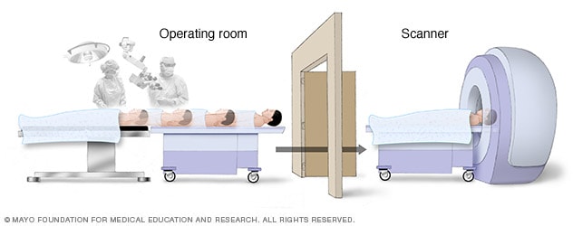 Computer-assisted brain surgery